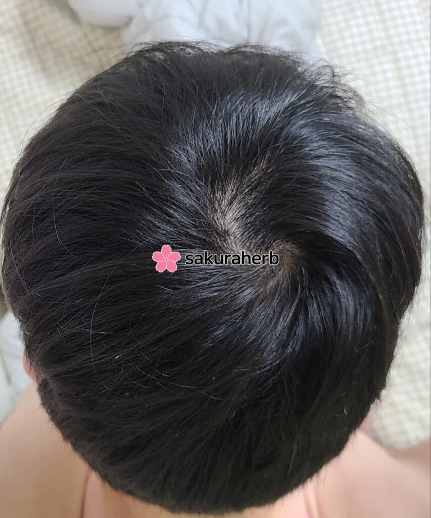 배송 너무 빠르고 고객 센터 상담도 친절,빨라요 !