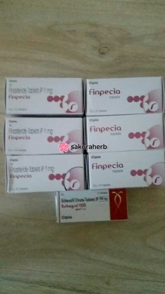 주문하고 5주 후 수령완료
