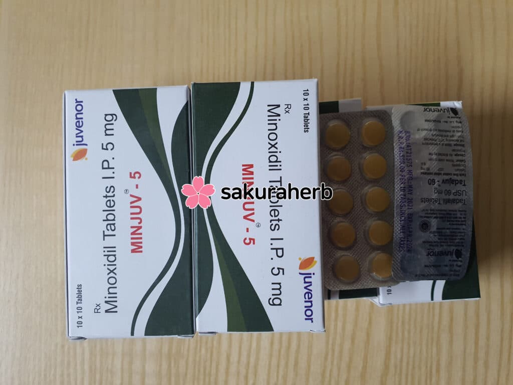 케바케인듯
