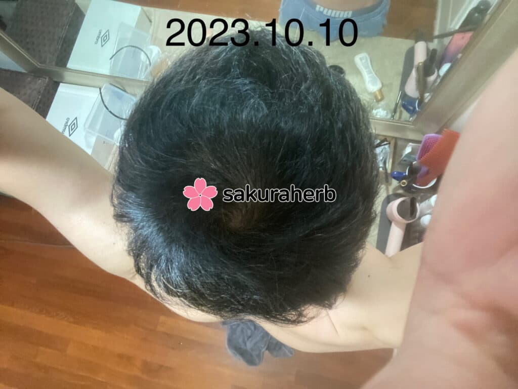 두가지 사용중입니다.
