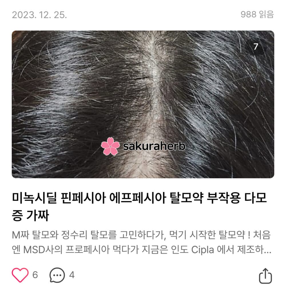 프리미엄후기 (녹시딜)
