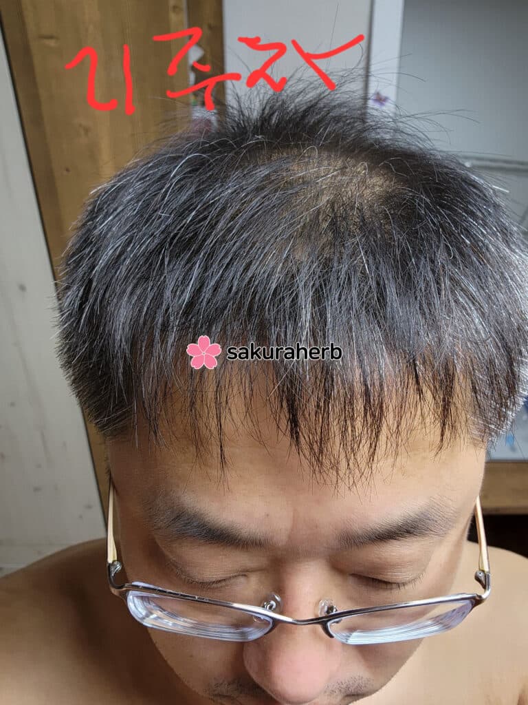 주문하고 3개월째 먹어봤습니다