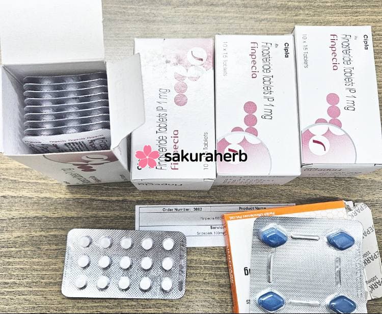 후기 - 에프페시아 (피나스테리드 Finasteride 1mg)
