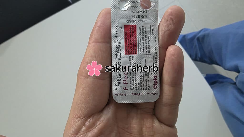 후기 - 에프페시아 (피나스테리드 Finasteride 1mg)