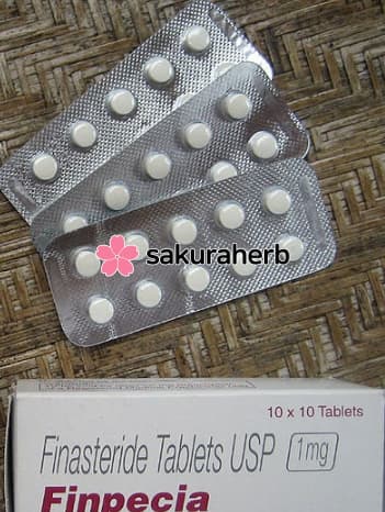 후기 - 에프페시아 (피나스테리드 Finasteride 1mg)