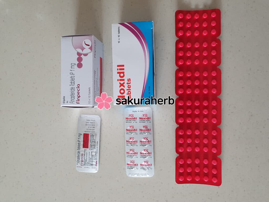 후기 - 녹시딜 테블릿 (미녹시딜 Minoxidil 5mg)