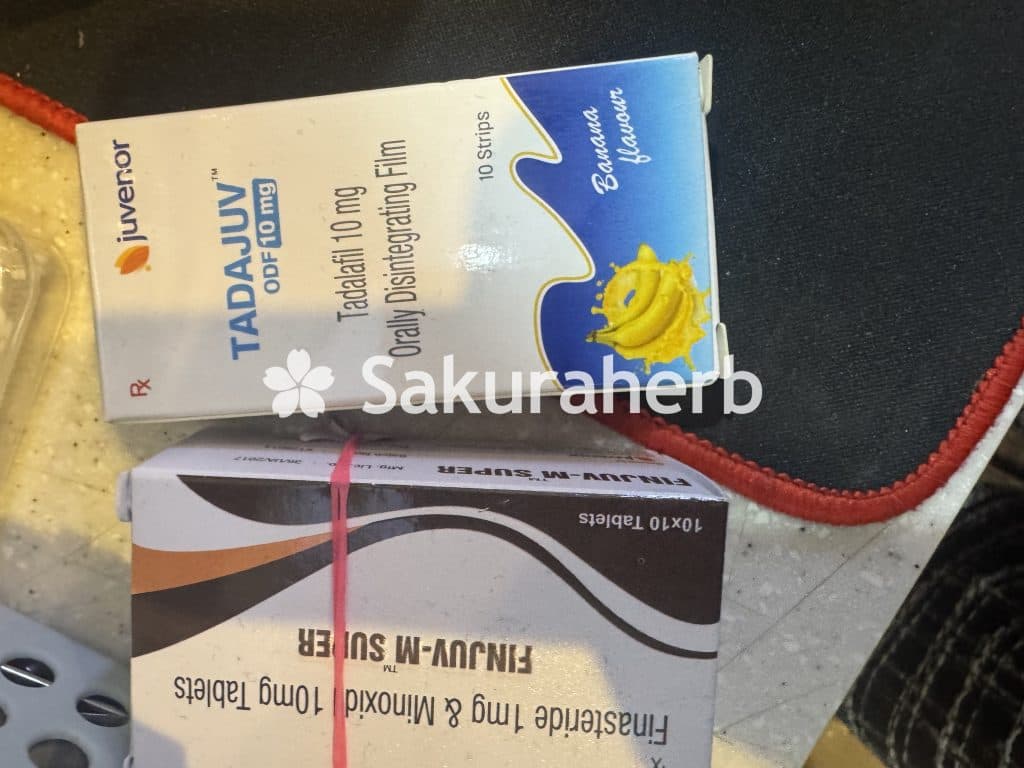 후기 - 두사트 + 미녹시딜 10 (두타스테리드 Dutasteride 0.5mg + 미녹시딜 Minoxidil 10mg)