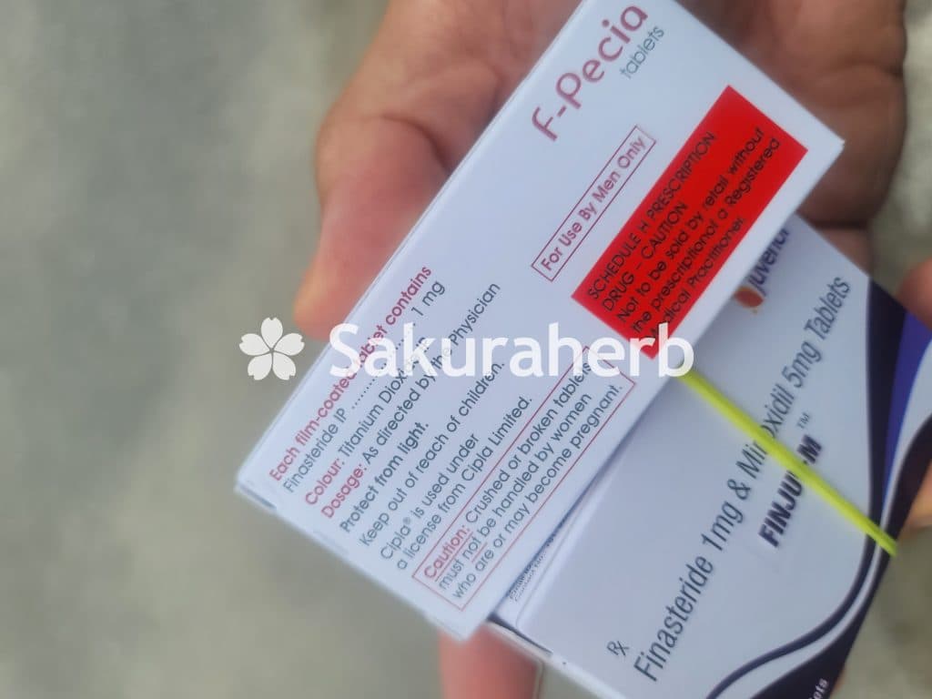 후기 - 에프페시아 (피나스테리드 Finasteride 1mg)
