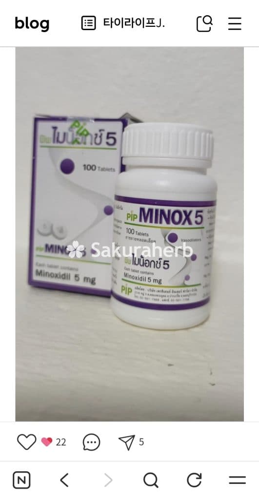 후기 - 미녹스 5 보틀 (미녹시딜 Minoxidil 5mg)