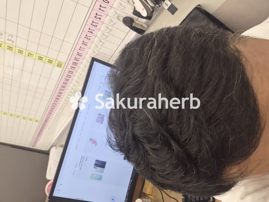 후기 - 에프페시아 (피나스테리드 Finasteride 1mg)