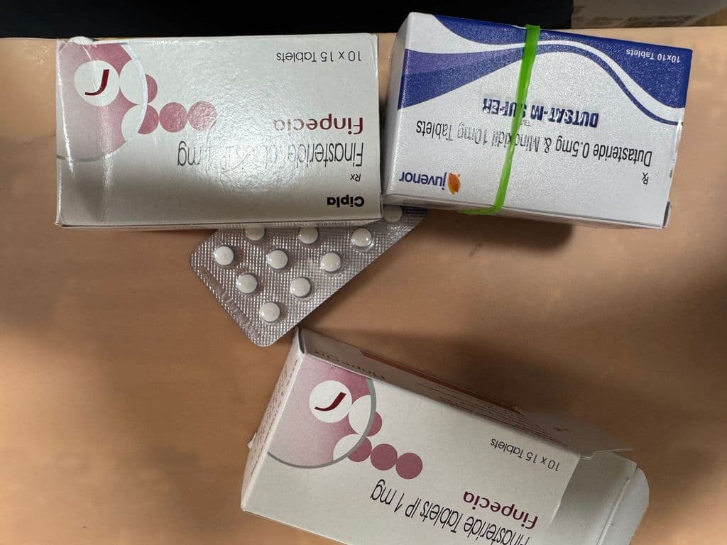 후기 - 핀페시아 300정 + 미녹시딜 5 300정 (피나스테리드 Finasteride 1mg + 미녹시딜 Minoxidil 5mg)