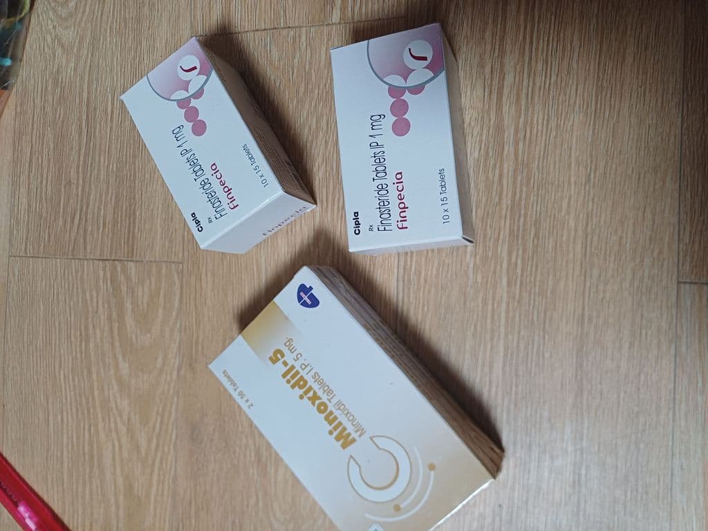 후기 - 핀페시아 300정 + 미녹시딜 5 300정 (피나스테리드 Finasteride 1mg + 미녹시딜 Minoxidil 5mg)